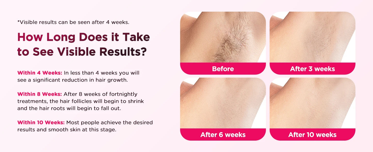 Painless IPL Laser Hair Removal Device